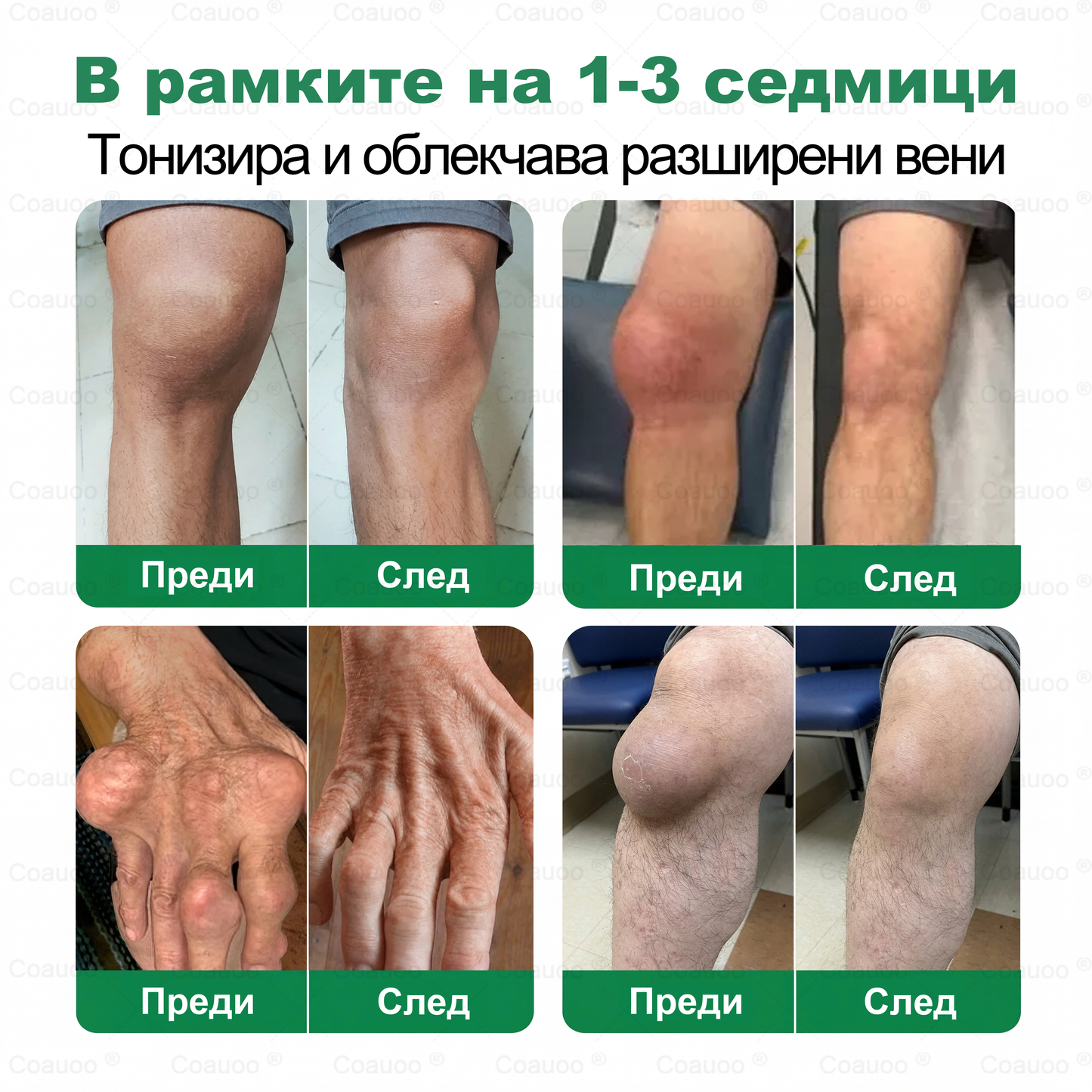 𝐂𝐨𝐚𝐮𝐨𝐨® Вена и Става Target Третиращ спрей ⚡ Незабавно облекчение, дълготрайни резултати – голяма промоция!