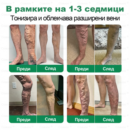 𝐂𝐨𝐚𝐮𝐨𝐨® Вена и Става Target Третиращ спрей ⚡ Незабавно облекчение, дълготрайни резултати – голяма промоция!